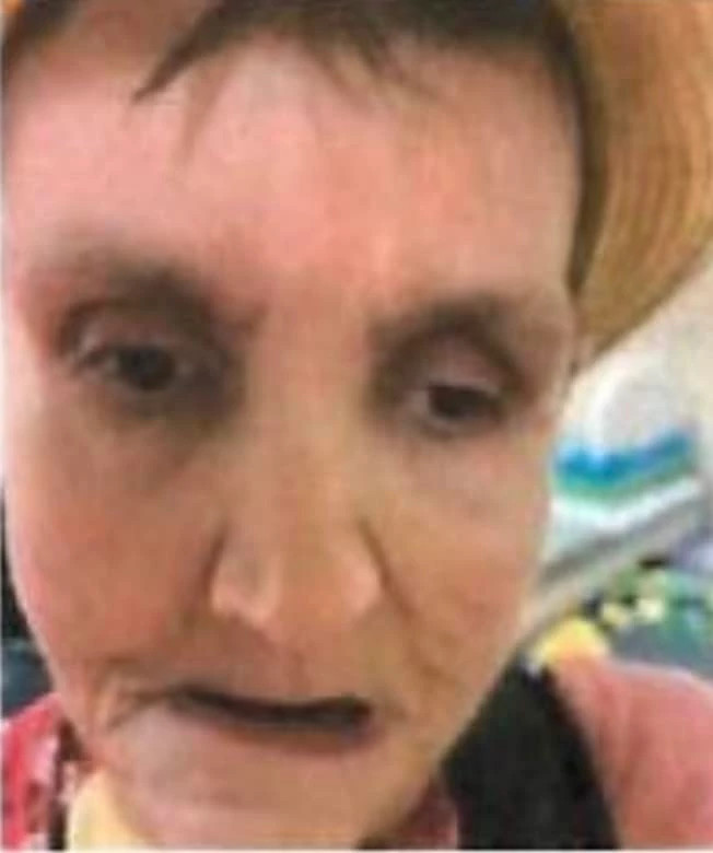 Coroner's Office Searching for Relatives of Woman Who Died at Tulare Rehabilitation Center